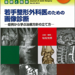 Joint Surgery