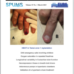 Diving and Hyperbaric Medicine Journal