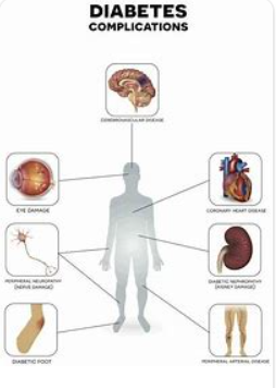 Diabetic Complications